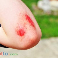 Soi cầu MB khi mơ thấy bị thương thì đánh lô đề con gì