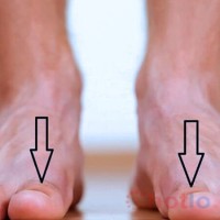 Soi cầu MB khi mơ thấy đôi chân thì đánh lô đề con gì