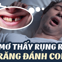 Mơ thấy gãy răng phải chăng điềm dữ đang bủa vây bạn?